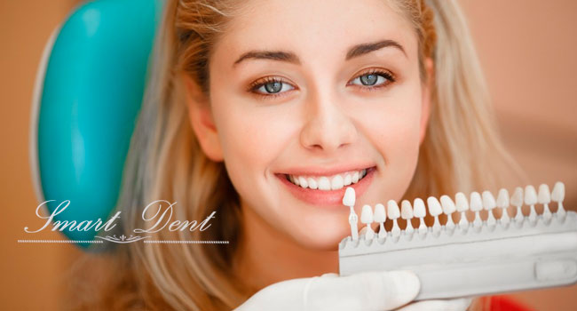 Скидка 50% на установку винира за 2 дня в стоматологической клинике Smart Dent

