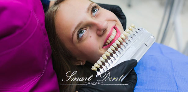 Скидка 50% на установку винира за 2 дня в стоматологической клинике Smart Dent
