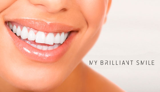 Экспресс-, двойное или глубокое косметическое отбеливание зубов в студии My Brilliant Smile. От 2 до 16 тонов! Скидка до 54% 
