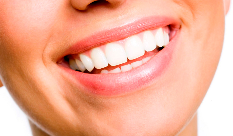Профессиональная гигиена полости рта, отбеливание зубов Amazing White, Zoom 4, Belle и Opalescence Boost в стоматологической клинике «Меда». Скидка до 84%