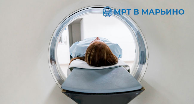 Скидка до 57% на МРТ головы, позвоночника, суставов и органов, комплексные исследования и прием невролога в центре «МРТ в Марьино»