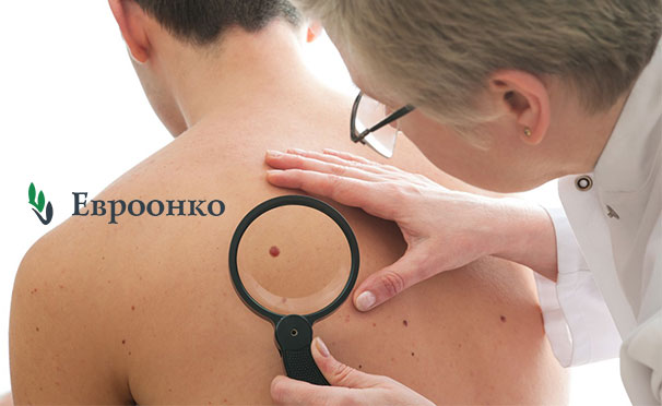 Скрининг кожи с помощью аппарата FotoFinder в клинике «Евроонко» со скидкой 30%