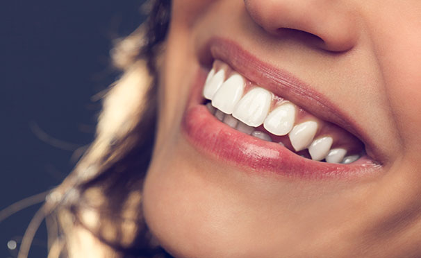 Лечение кариеса с установкой пломбы, УЗ-чистка и отбеливание зубов в стоматологической клинике «Амистад». Скидка до 83%