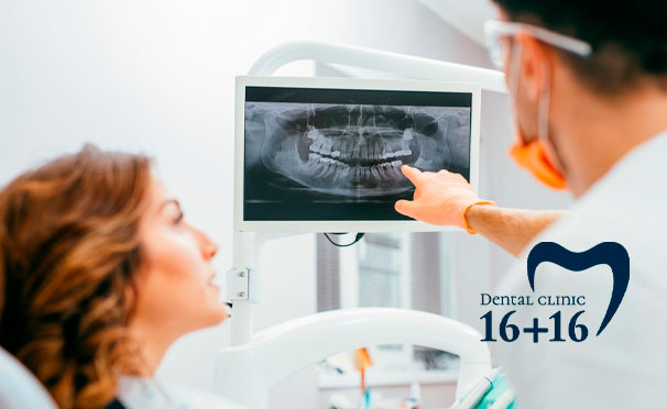 Компьютерная томография 2 челюстей и профессиональная гигиена полости рта в стоматологической клинике «16+16» со скидкой 50%